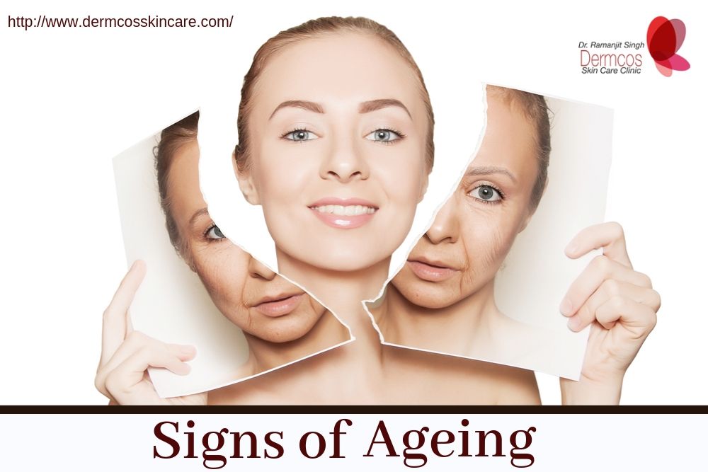 Read more about the article Early Signs of Ageing and Methods to Combat