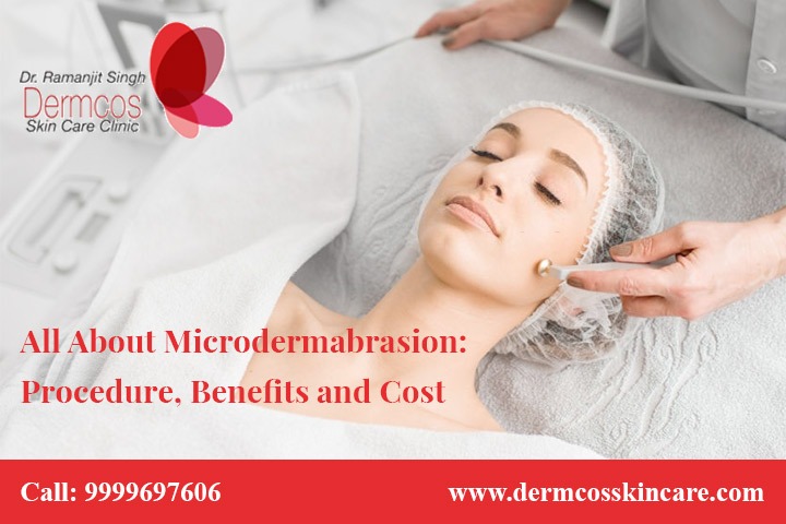 Read more about the article Microdermabrasion: Preparation, Procedure, Benefits, and Cost.
