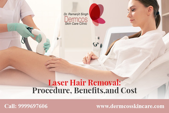 Read more about the article Laser Hair Removal-Procedure, Benefits, and cost