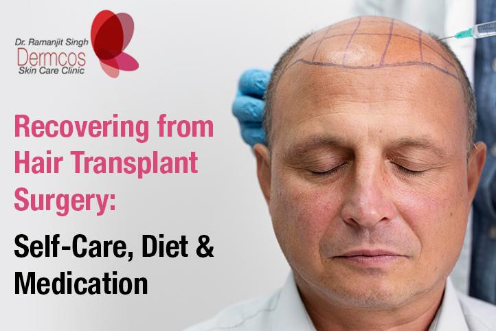 You are currently viewing Recovering from Hair Transplant Surgery: Self-Care, Diet & Medication