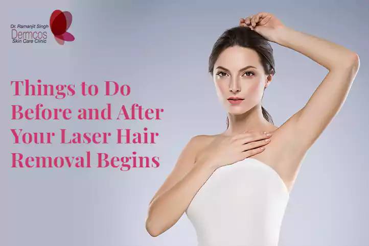 You are currently viewing Things to Do Before and After Your Laser Hair Removal Begins