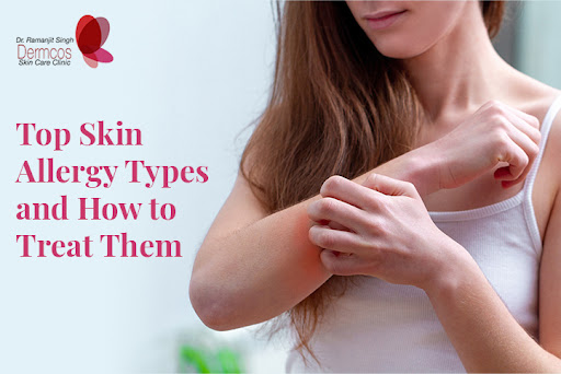 You are currently viewing Top Skin Allergy Types and How to Treat Them