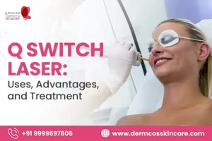 Read more about the article Q Switch Laser: Uses, Advantages, and Treatment
