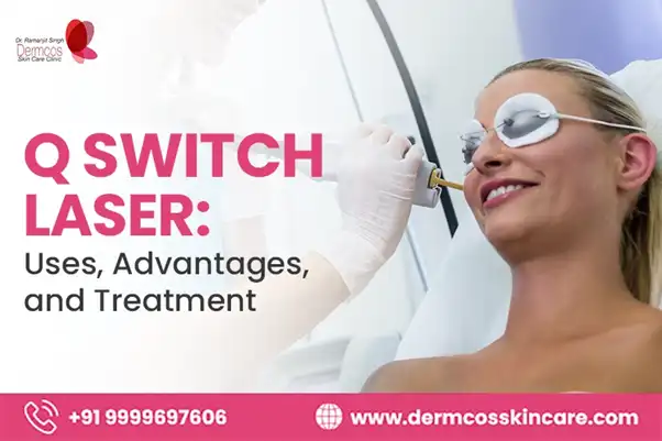 You are currently viewing Q Switch Laser: Uses, Advantages, and Treatment